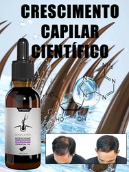 Essência para crescimento capilar, produtos de óleo eficaz para calvície, tratamento de reparo rápido, anti-hereditário, perda de alopecia seborréica para homens e mulheres