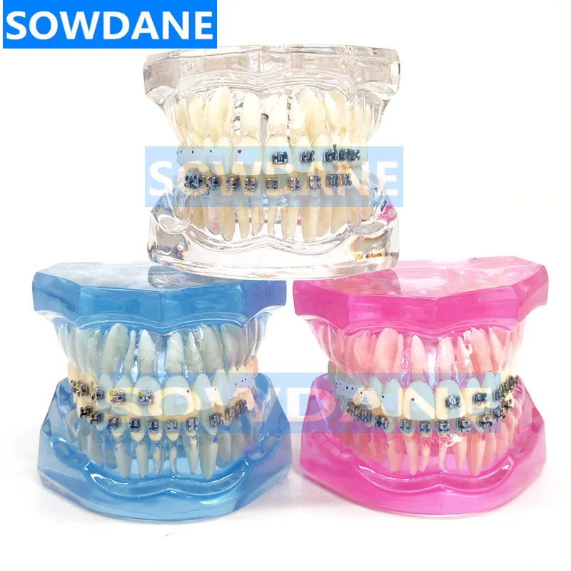 Dental Orthodontic Model Patients Communication 4 kinds Brackets with Ceramic Bracket Metal Self Ligating Braces Tooth Mold