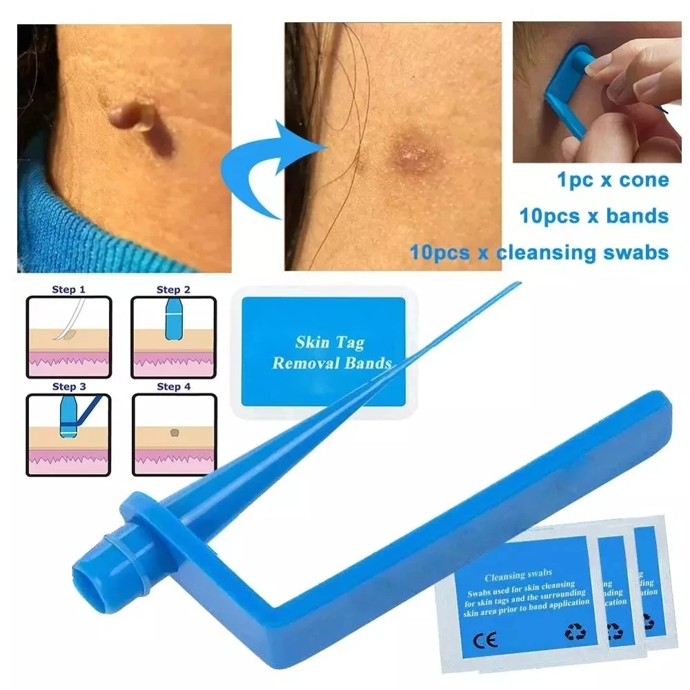 Skin Tag Removal Kit Papilloma Removal Skin Cleansing Band Kit For Remove Skin Berrugas Wart Dots Mole Removal Beauty Appliances