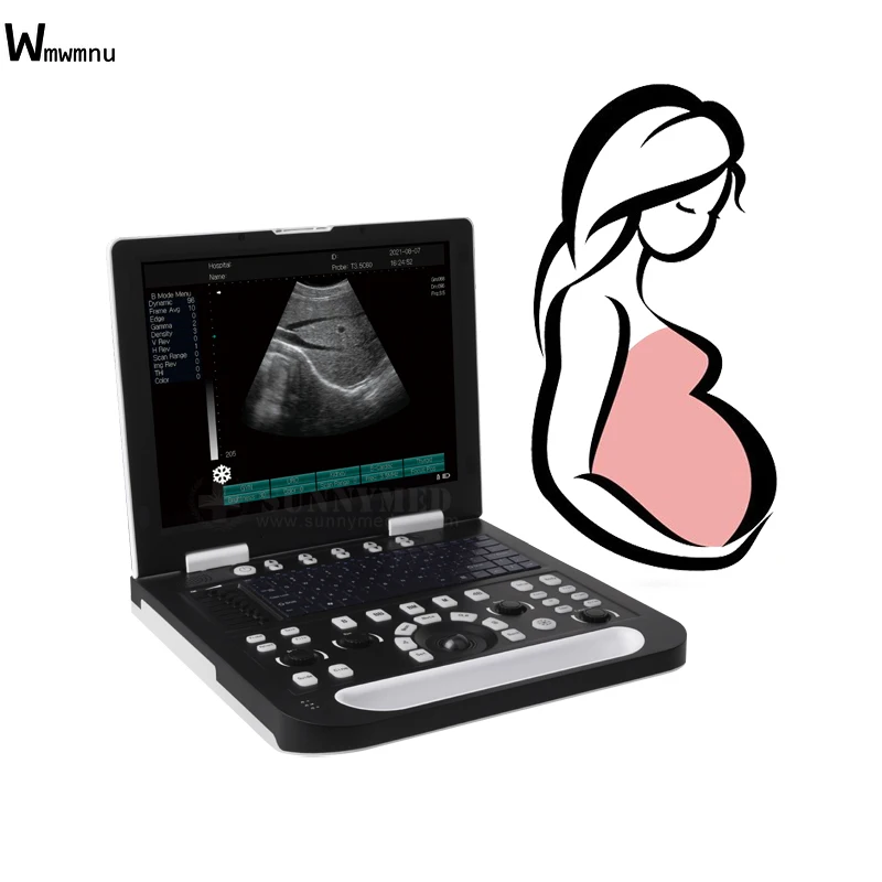 SY-AN50 High-end Ultrasound Radiology Equipment  5 In 1 Mini Wifi Handheld Wireless Portable Handheld Ultrasound Machine