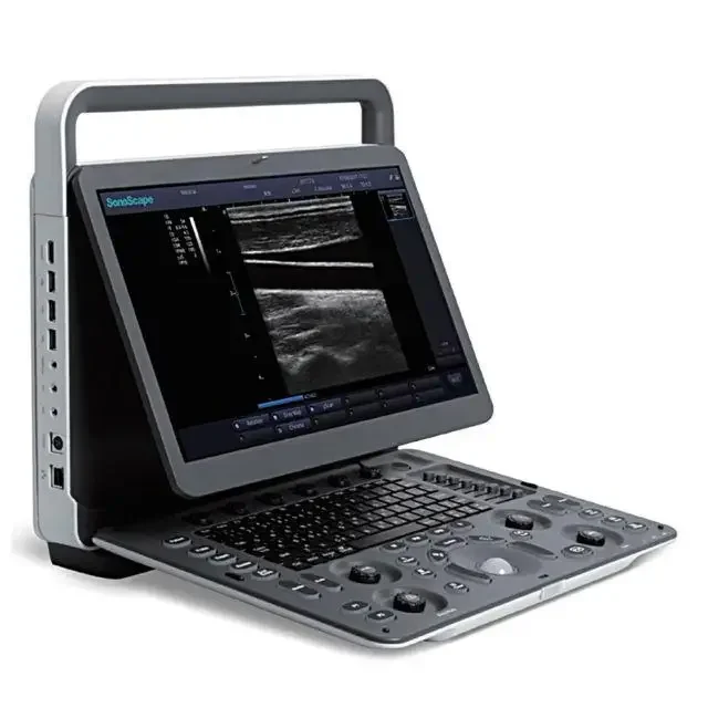 Sonoscape E1 E2 E3 Portable Ultrasound High Quality E1 Ultrasound Instruments Portable Color Doppler Ultrasound