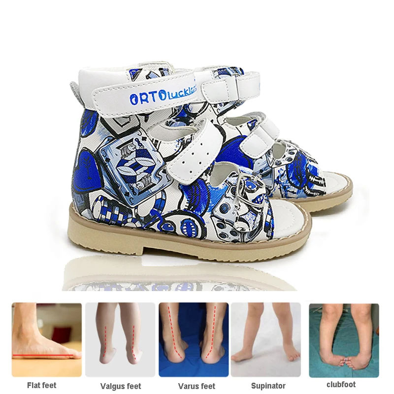

Ortoluckland/детская обувь, летние детские ортопедические сандалии для мальчиков, обувь с пряжкой и ремешком для малышей, размер от 20 до 32