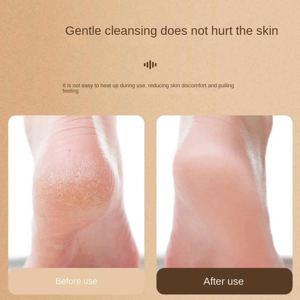 甘皮カルス除去電動フットサンダーマシンUSB充電式硬くなったひび割れた皮膚のトリマーフットグラインダー