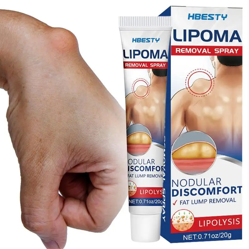 Lipoma Removal Cream Relief Swelling Fat Elimination Cream 20g Remove Subcutaneous Lump Herbal Extract Care Fat Bulges Lump