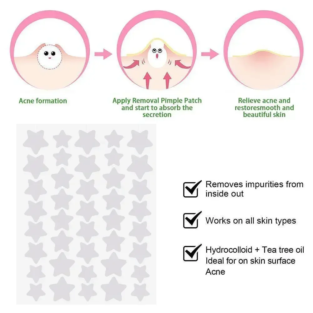 별 모양 여드름 여드름 패치, 보이지 않는 컨실러, 방수 잡티 스팟 여드름 치료, 얼굴 미용 스킨 케어, 40 개