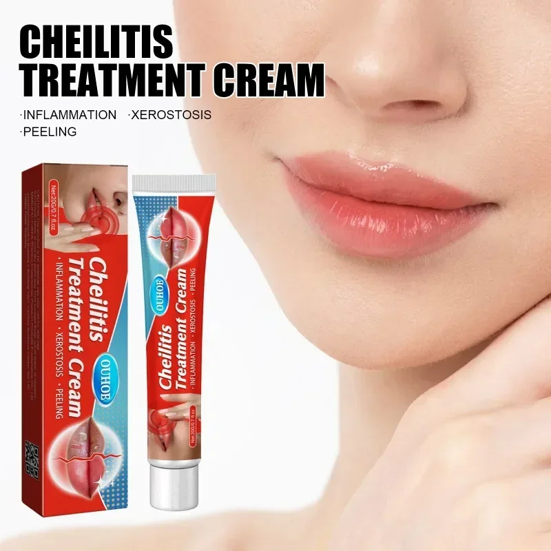 Crema para tratamiento de Cheilitis labial, ungüento antibacterial para Herpes, labios agrietados, arrugas, rehidratación, yeso para el cuidado de los labios