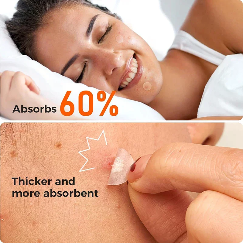 

435 шт. невидимые пластыри для удаления прыщей против прыщей, пятна, консилер, инструмент для макияжа, ремонтная наклейка