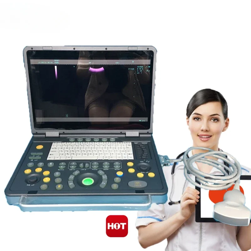 

Portable laptop full digital B model ultrasound machines