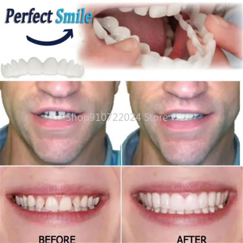 2Pcs/Set Silicone Teeth Whitening Teeth Cover Teeth Braces Simulation Denture Upper Teeth Lower Teeth Set with Box Perfect Smile