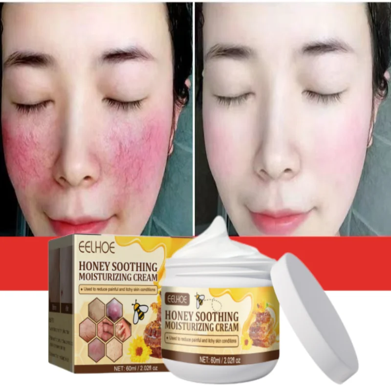 Eficiente 7 Dia Facial Vermelhidão Creme, Reparação para a pele sensível, Sooth, Anti nariz vermelho, acne, cravo, espinhas, encolher poros, pele mais clara