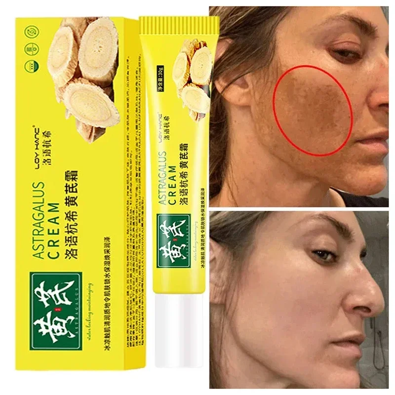 Chinese Astragalus Whitening Freckles Cream Remove Melasma Fade Dark Spots Dark Yellow Skin Brighten Anti-aging Face Skin Care