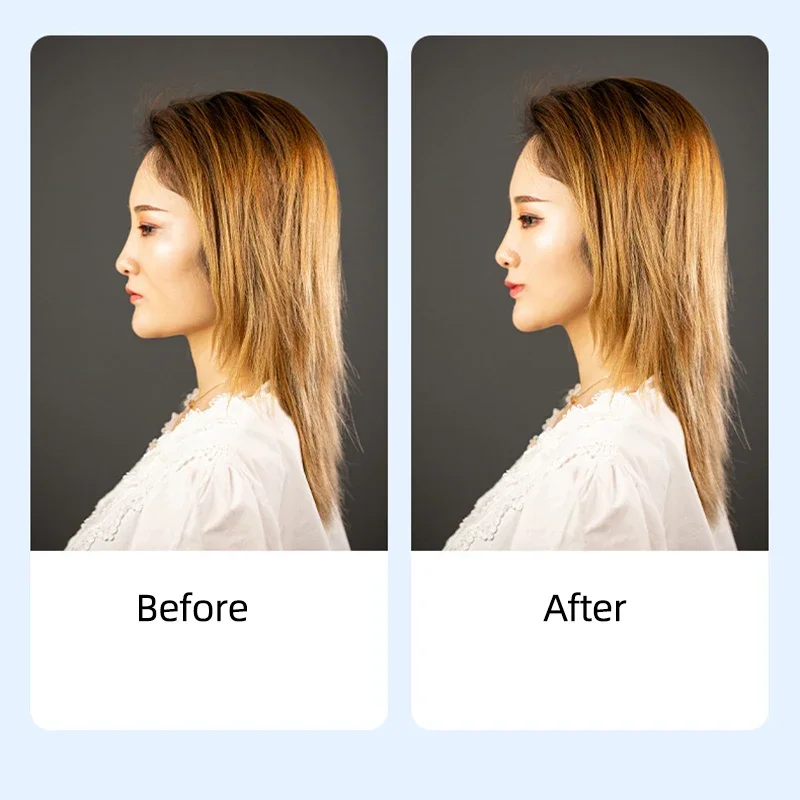 再利用可能なダブルベルトインスタントフェイスリフトバンド、目に見えないヘアピン、眼帯の除去、顔のリフトテープ、1個