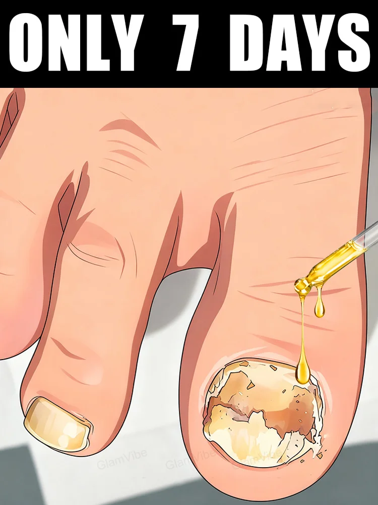 

ᑫᵘⁱᶜᵏ ᵀʳᵉᵃᵗᵐᵉⁿᵗ⸴ ᔆᵃʸ ᴳᵒᵒᵈᵇʸᵉ ᵗᵒ ᶠᵘⁿᵍᵃˡ ᴺᵃⁱˡ ᵂᵒʳʳⁱᵉˢHot-selling nail cleaning brush