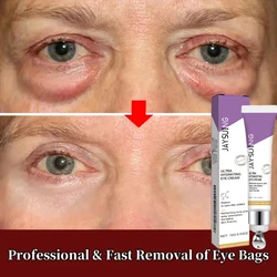 Instant Eye Bag Removal Cream Retinol Anti-Wrinkle Firming Skin Fade Fine Lines Anti Dark Circle Puffiness Brighten Eye Care