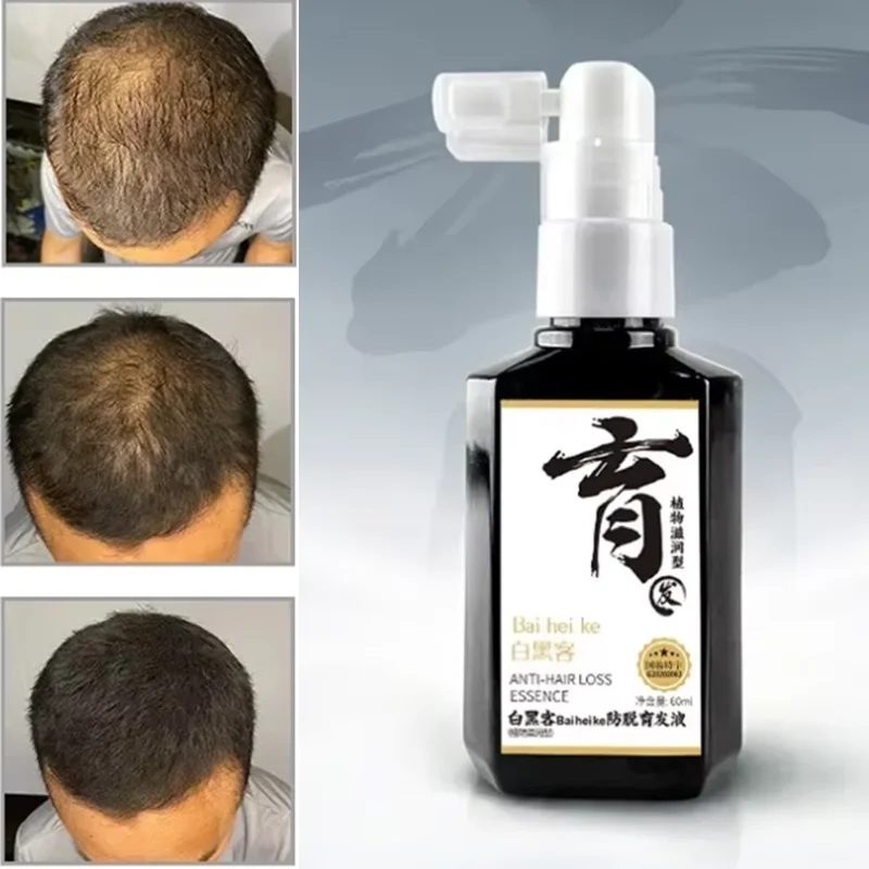 

50ml Hair Nourishing Liquid Hair Growth Liquid and Densification Essence Scalp Care Essence Hair Care