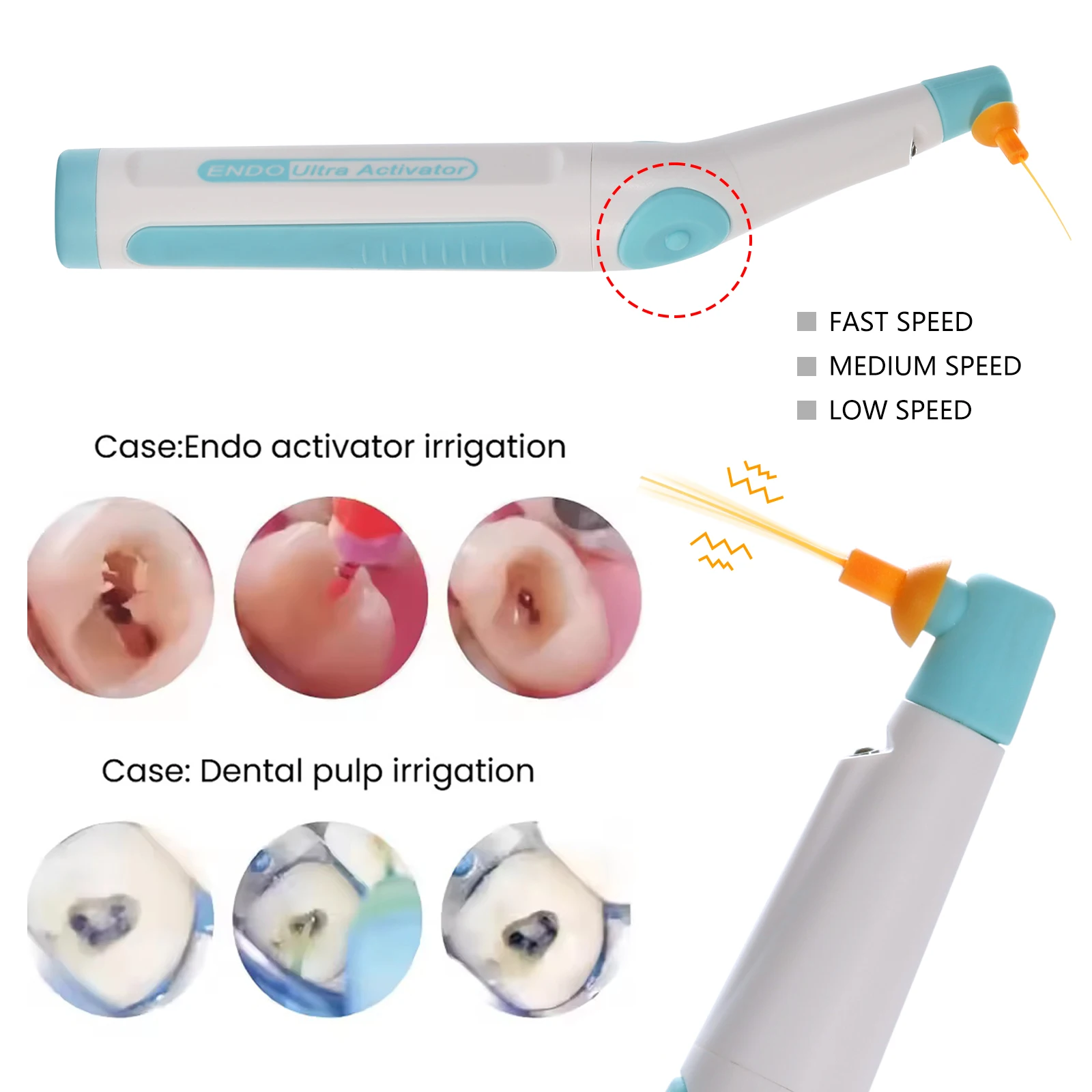Dental Endodontic Endo Ultra Activator Handpiece LED Light Root Canal With 150 Sonic Irrigator Tips  Dentistry Instrument Tools view 5