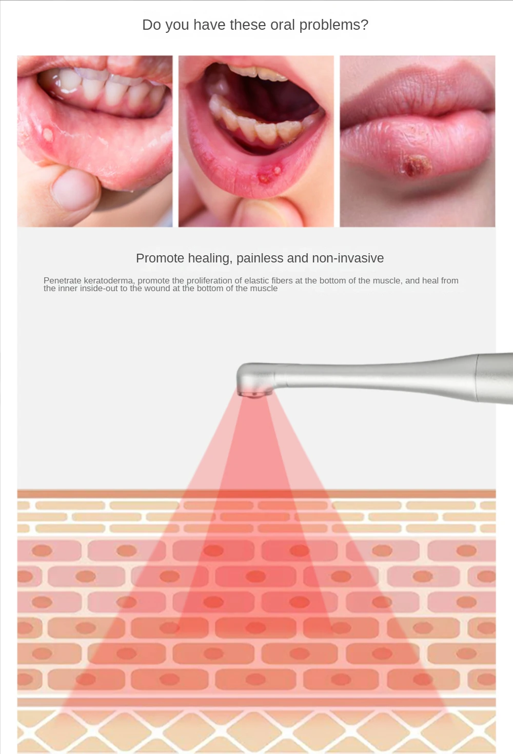 Dispositivo de terapia de luz roja de mano, tratamiento de terapia de luz infrarroja para labios boca nariz oreja rodilla, tratamiento de dolor frío