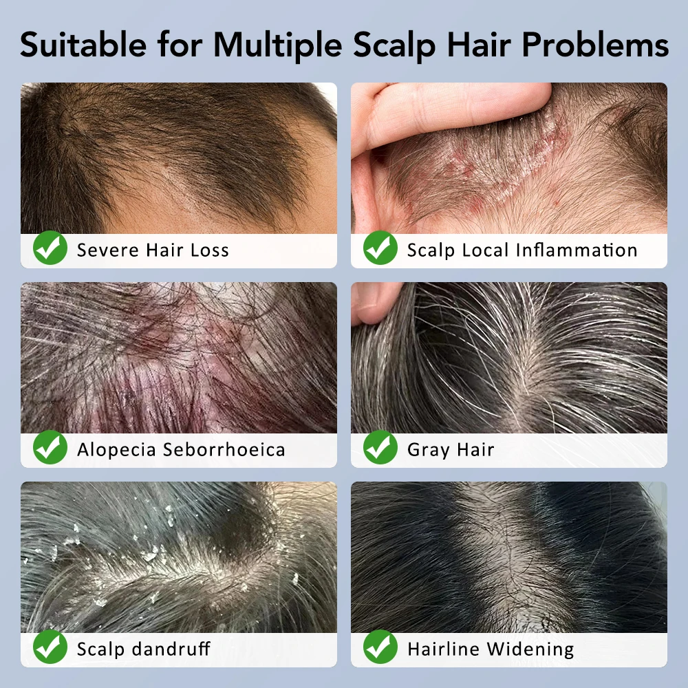 Рисунок 2 - Визуальный аппликатор для кожи головы