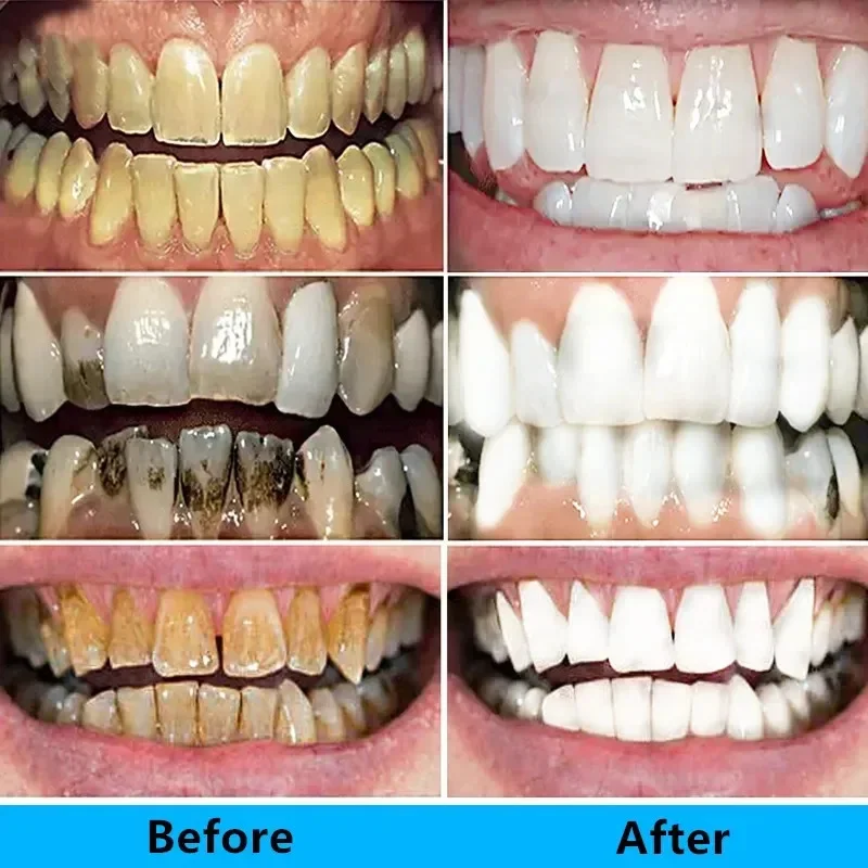 Whitening Teeth Toothpaste Plaque Stains Remover Mouth Odour Removal Bad Breath Clean Fresh Breath Dental Tools Products