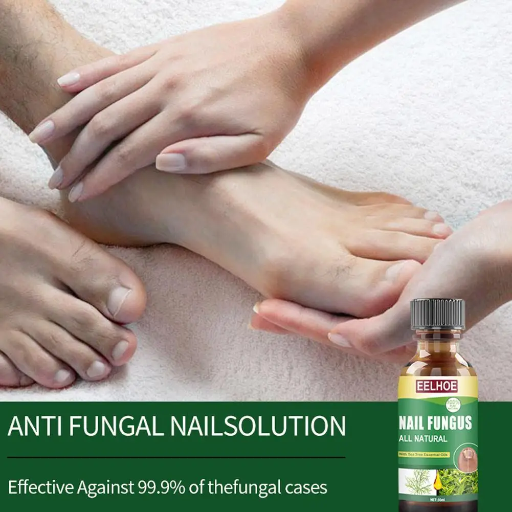 Unha Fungal Tratamento Cuidados Essence, Clareamento do pé, fungo, Paroníquia Infecção, Remoção Unhas Gel, Anti Onicomicose, K7O7