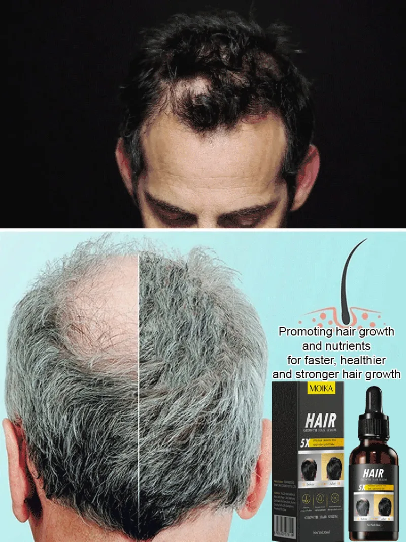 Serum pertumbuhan rambut, Pembersih mendalam, menutrisi kulit kepala mengurangi rambut rontok, meningkatkan pertumbuhan rambut dan meningkatkan rambut kering