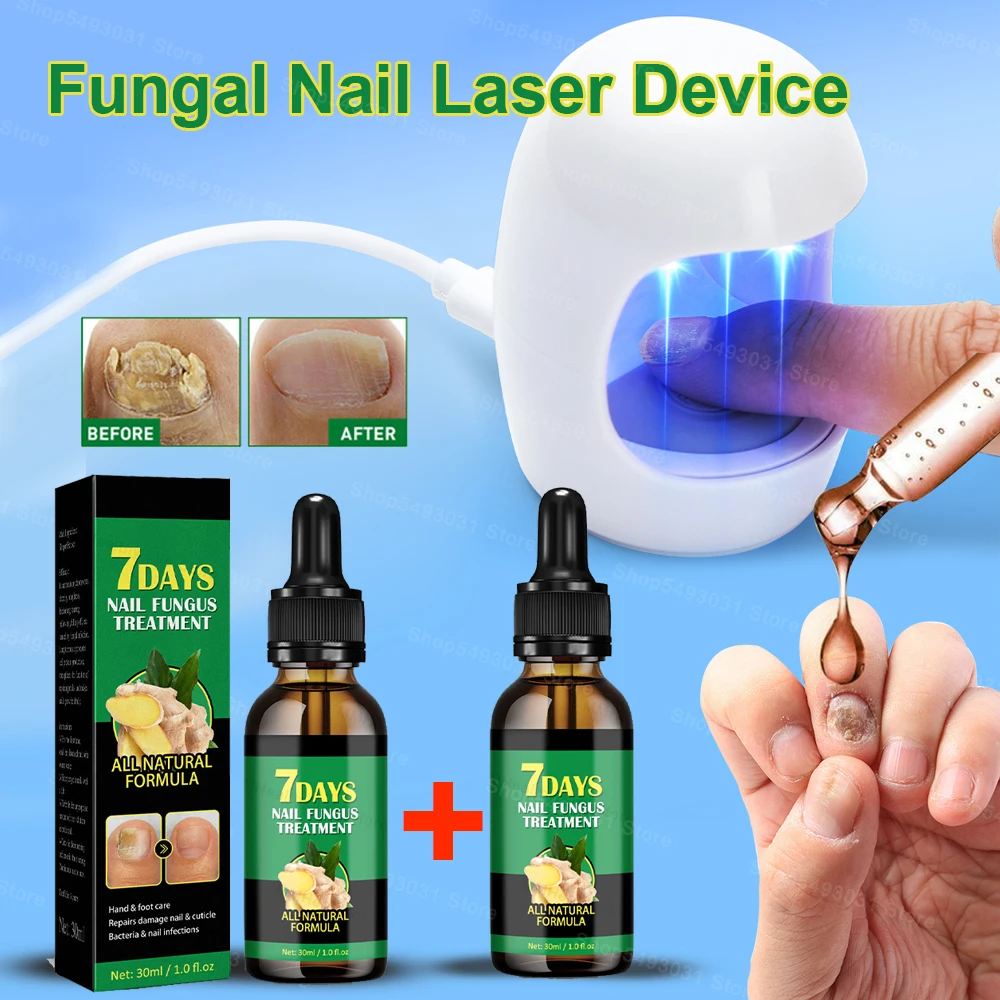 Nail Fungus Laser Treatment Feet Onychomycosis Repair Toenail Nails Device Fingernail Health Care