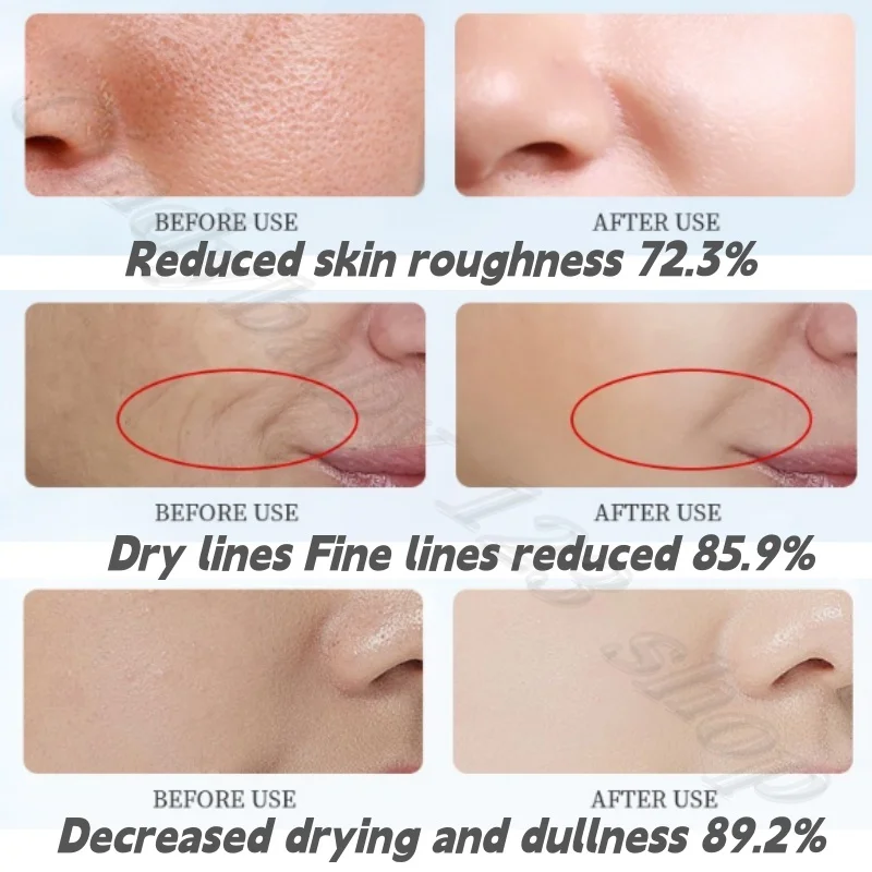 كريم جل كريستال آيس كريستال مهدئ للعضلات من بيوتي، مغذي، مرطب، منعش، تحسين مملة وخشنة مضادة للشيخوخة 30 مل #4