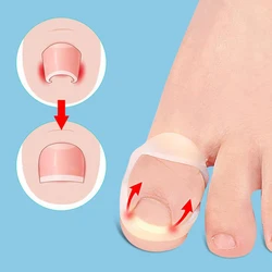 Silicone Ingrown Toenail Correction Tool Invisible Ingrown Toe Nail Treatment Elastic Straightening Clip Brace Pedicure Tool