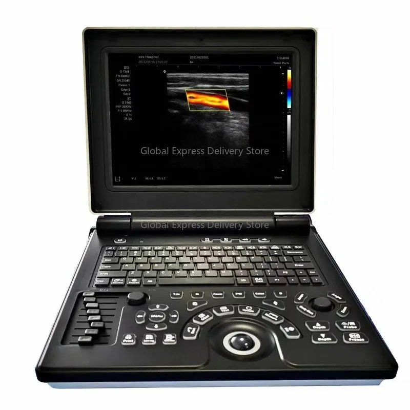 

For Veterinary Clinics: 3D Color Pet Ultrasound Diagnostic Machine – Notebook-Style, Fits Small & Large Animals