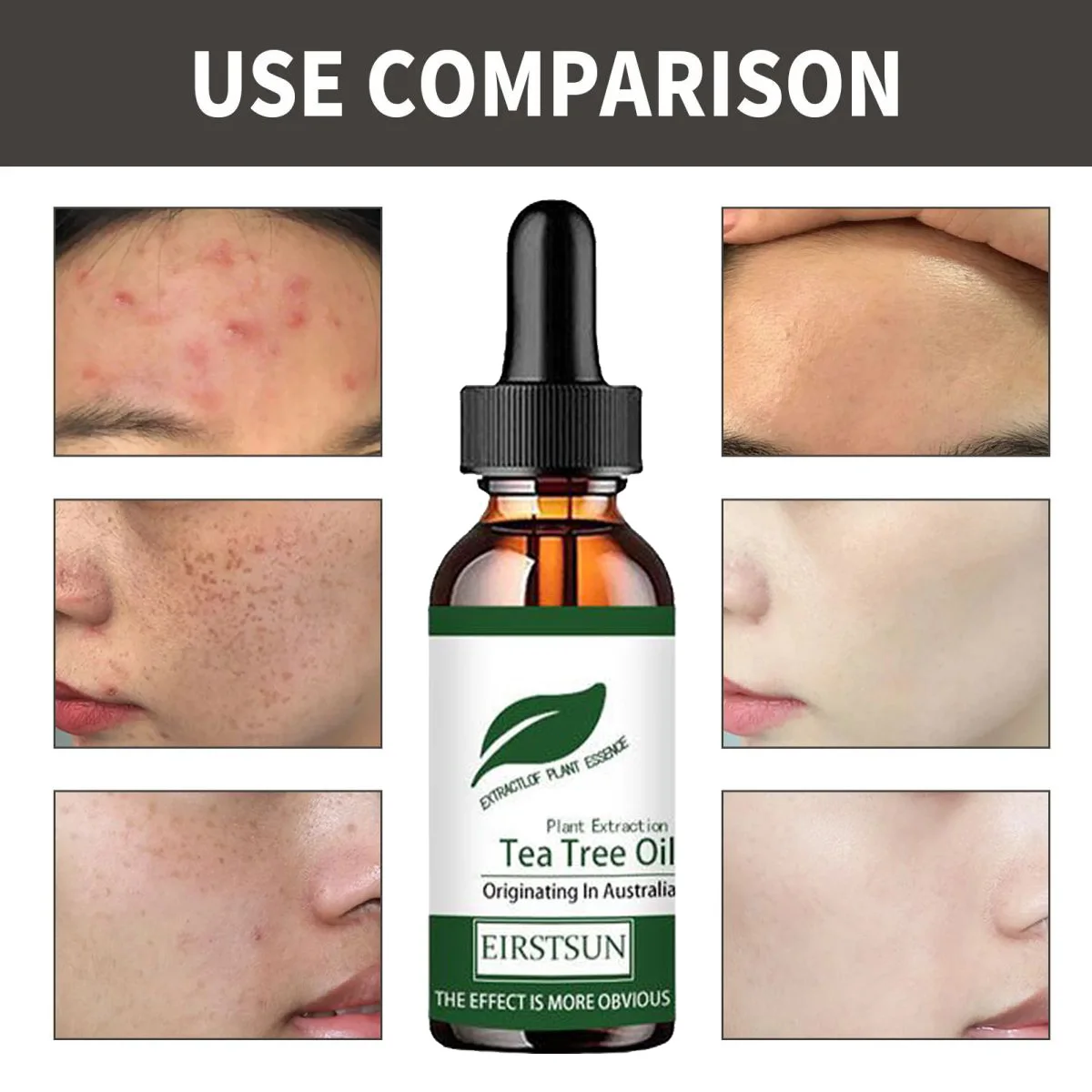 

Natural Tea Tree Oil Moisturizer Face Body Skin Care For Women Hair Care Fragrance Aromatherapy Pure Massage Essential Oil