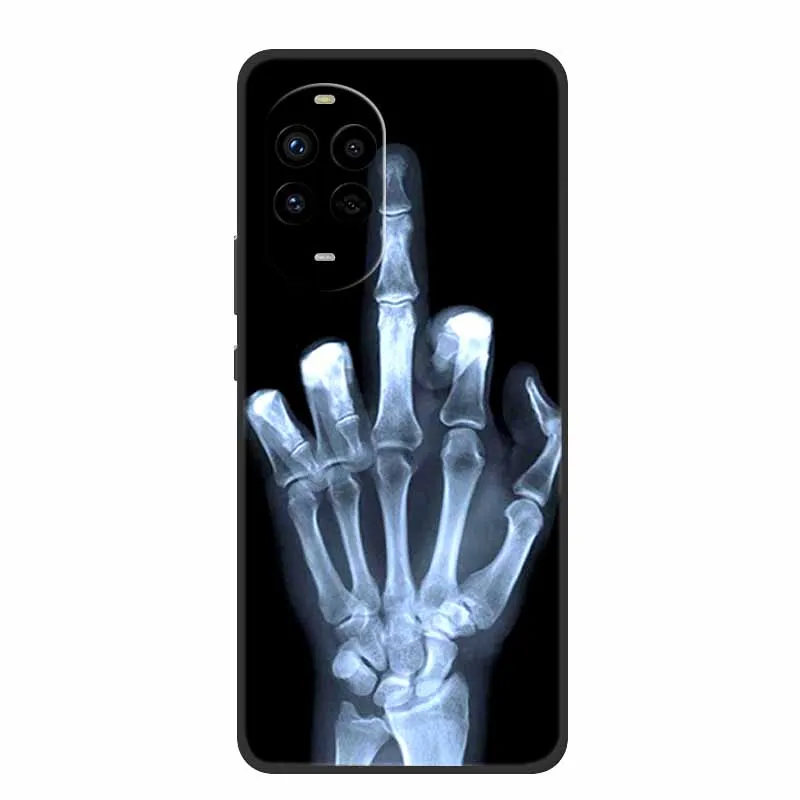 Für Huawei Nova 13 Pro Fall 13 Pro Schwarz Silikon Weiche Rückseitige Abdeckung Fall Für Huawei Nova 13 Pro Telefon Fall 6,76 "Schutzhülle Coque