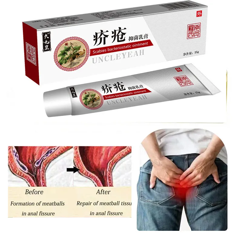 Hemorrhoids Treatment Cream Herbal Cream Mixed External Internal Anal Fissure Pain Relief Treatment Cream Health Care