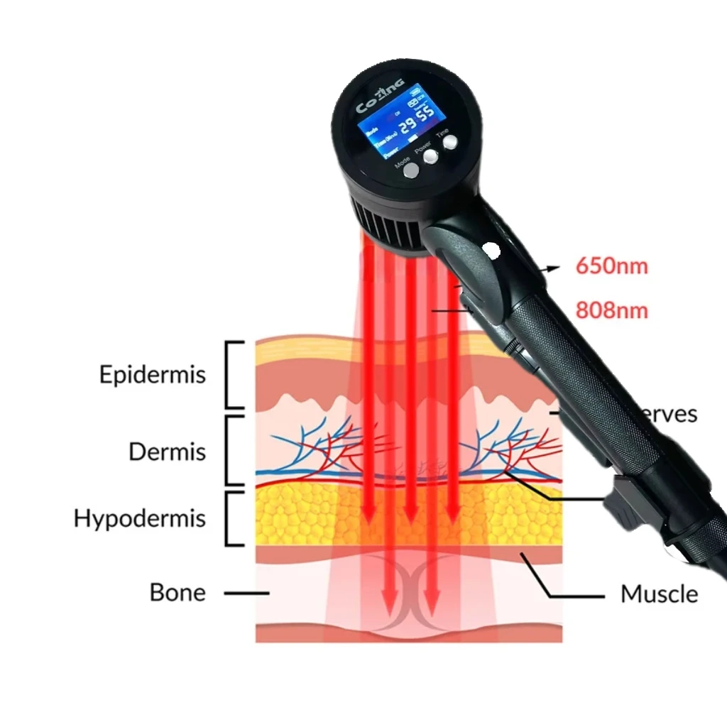 

HLKGO Portable 3W Physio Laser Device 6x808nm+19x650nm - Cold Laser for Knee Pain Relief & Chronic Pain