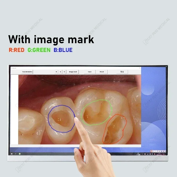 Intras Orals Cameras HD Cameras 24 Inches Touch Screens With Monitors Dentals Surgerys LED Handles Dentals Oral Cameras