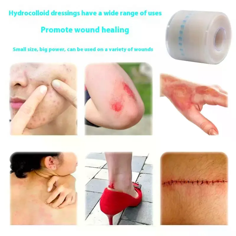 1 Roll Hydrocolloid Band Aid Dressings For Effective Wound Care Extra Thin Soft Waterproof Self-Adhesive Scar Cover Tape