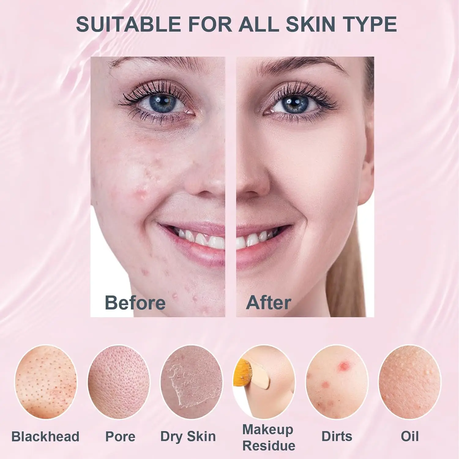 Depurador facial de silicona, cepillo de limpieza facial eléctrico impermeable para hombres y mujeres, depurador facial recargable con 5 modos para