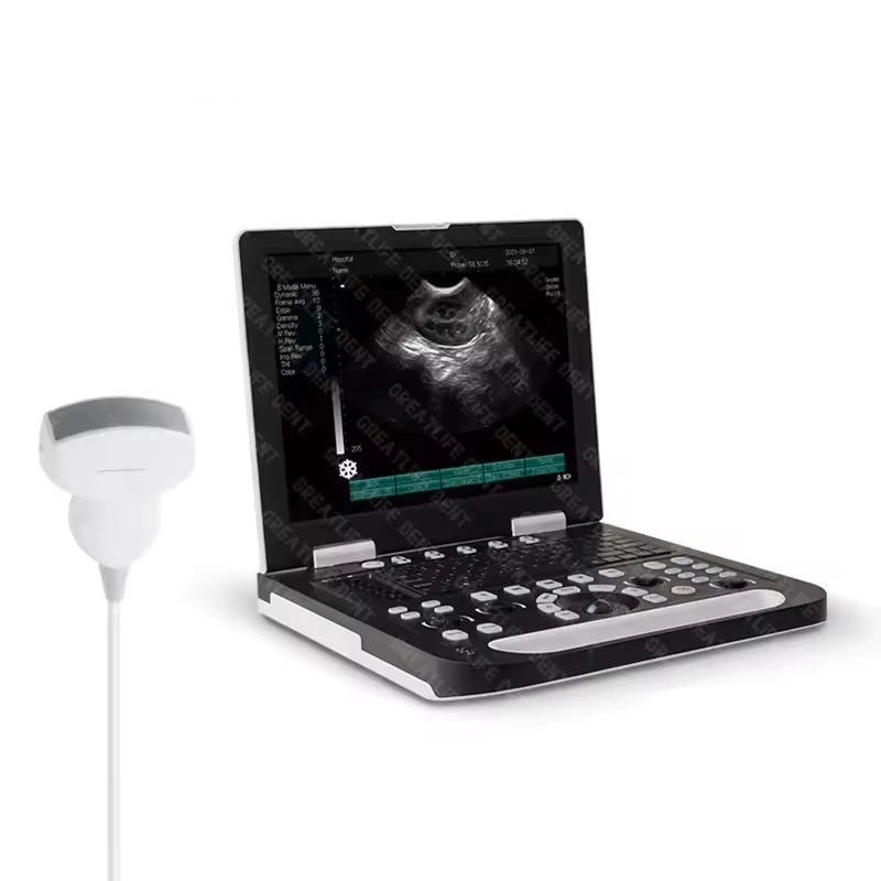 15 Polegada tela cheia soquetes de sonda dupla portátil notebook b ultrassom usg scanner máquina