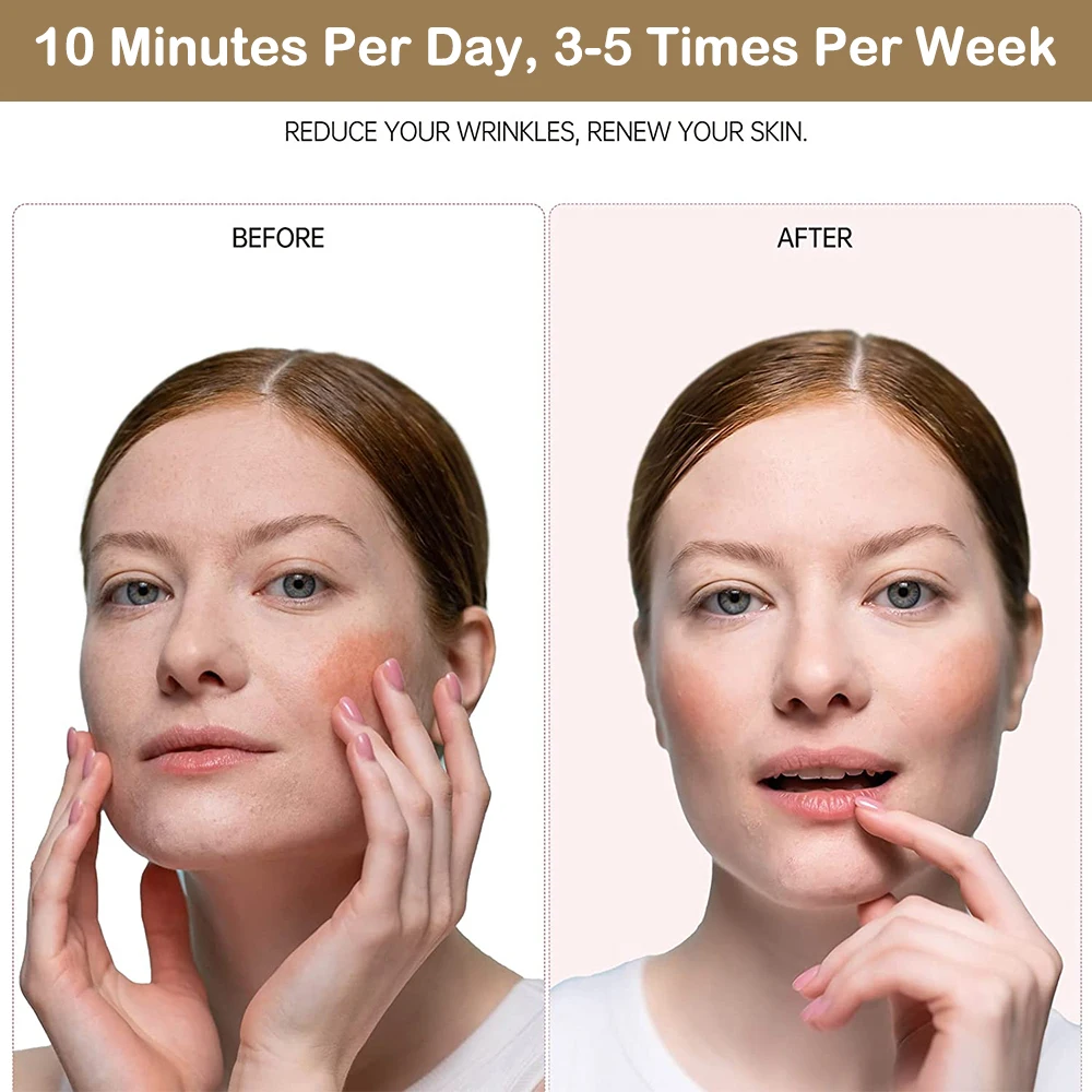 EMS Microcurrent Face Lift Device – LED + Heating + Vibration Facial Massager