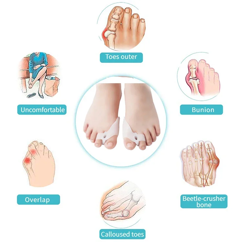 مصحح أروح الإبهام، مصحح أروح الإبهام، فاصل أصابع القدم، فاصل السيليكون #5