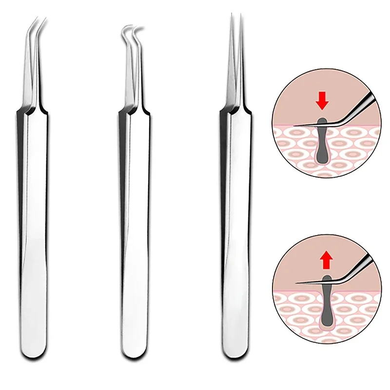 3-18Pcs Cell Pimples Blackhead Remover Clip Ultra-Fine Tweezers Black Dots Blackhead Extractor Acne Needle Facial Cleaner Tool