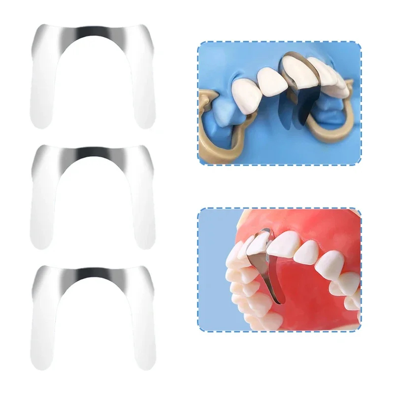 10/30pcs Lab Matrix Bands M8 2.0 Anterior Sectional Contoured Matrix System Metal Matrix Bands Tooth Restoration Materials