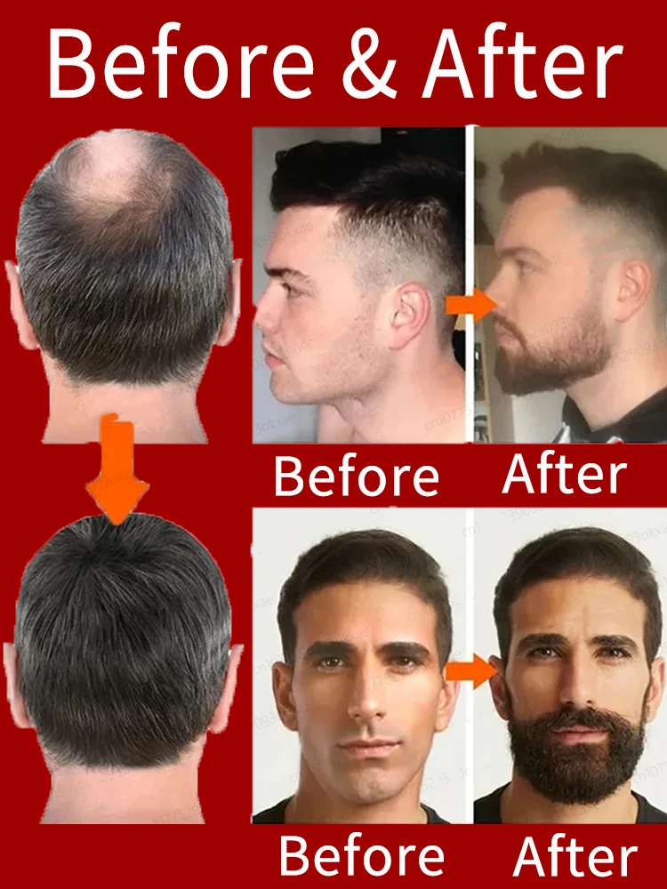 نمو الشعر السريع liuid·اللحية يزيد من شعر الصدر يتضمن جميع أنواع شعر الجسم بشكل فعال في أي الصلع وتساقط الشعر