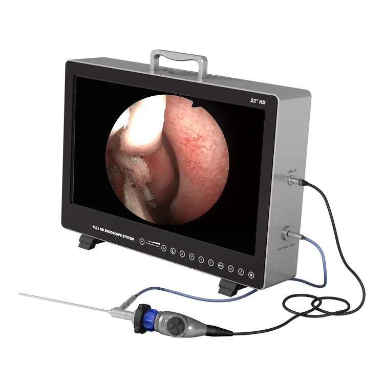 1080P Integrated HD Endoscope With HD Video Recording Function For Urology Hysteroscopy Laparoscopy ENT