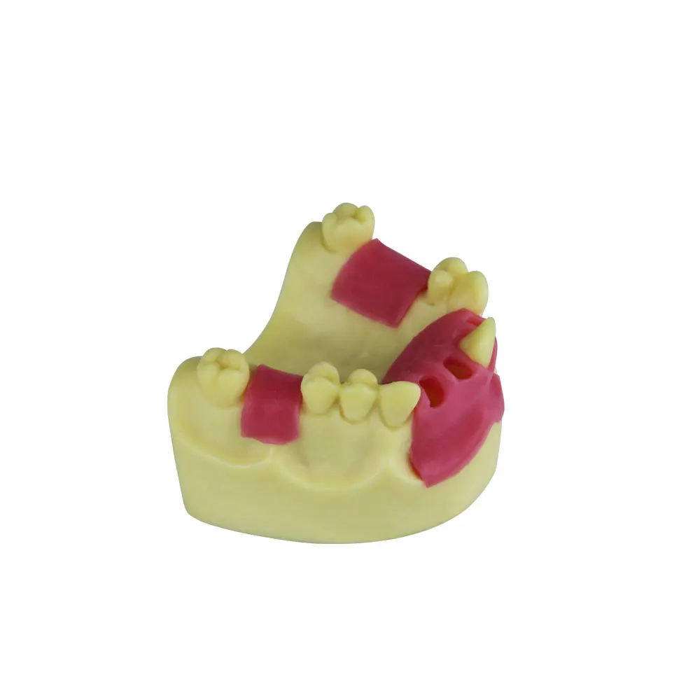 Upper Jaw Dental Model Implant Teeth Model For Studying Training Teaching Education Demo   Missing Tooth Implant  Practice Model