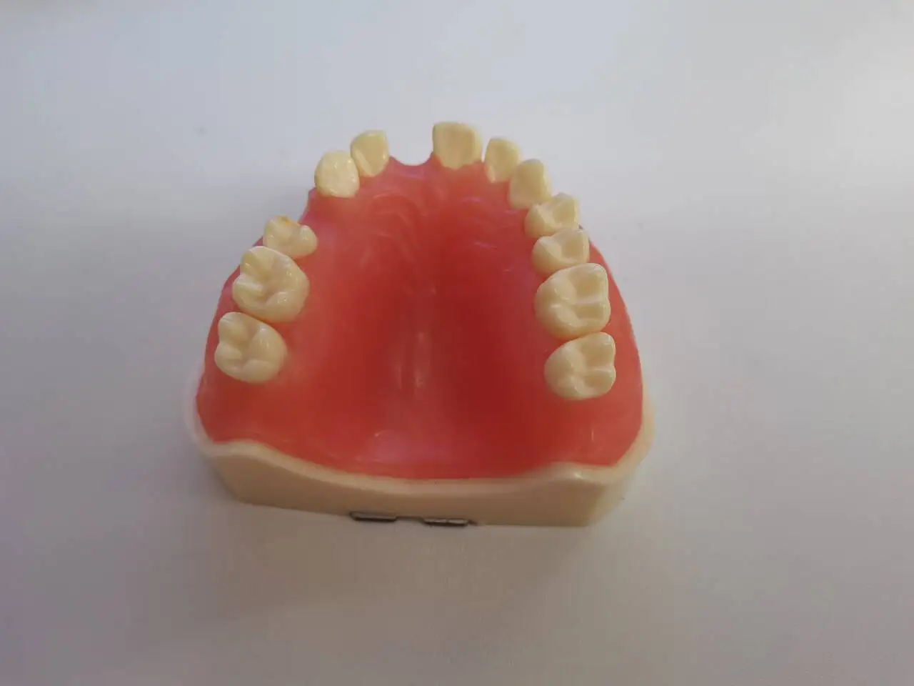 Dental Anatomy Caries Oral Model Dental Implant Model Upper Lower Jaw Models Teaching Study Communication Tool