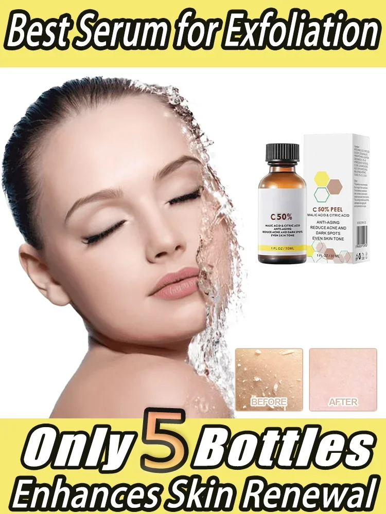 Face Care Exfoliating Yellow Peeling Oil Chemical Peel  Bleaching Dark Skin Remove Spots Arm Knee Legs Melanin Pigmentation