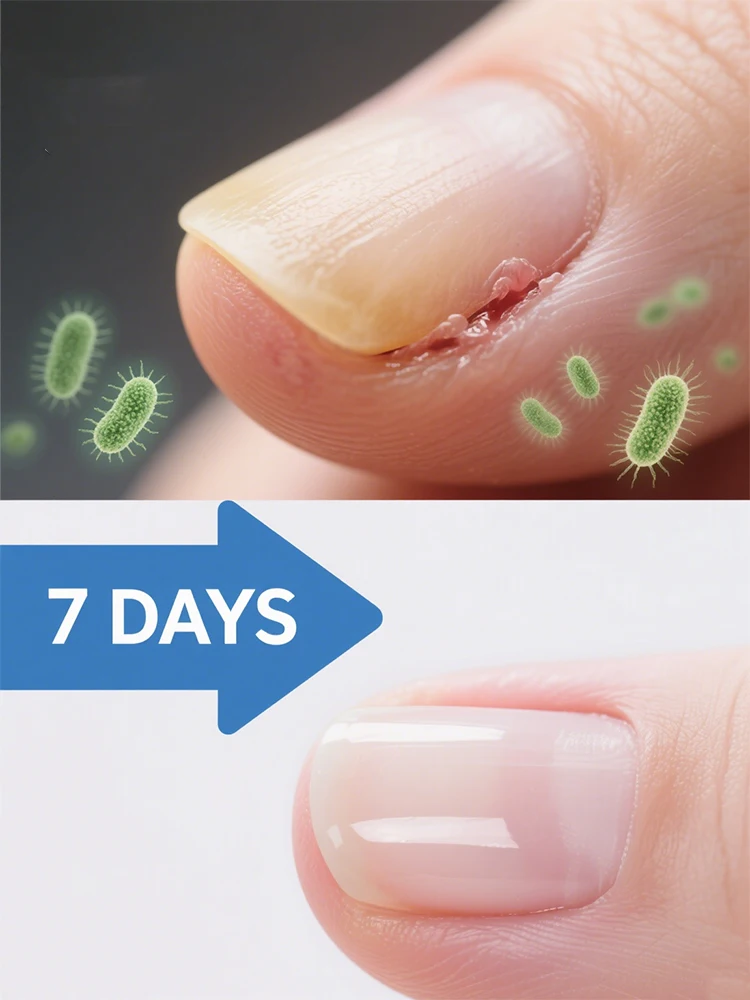 

Moisturizing your toes is easy