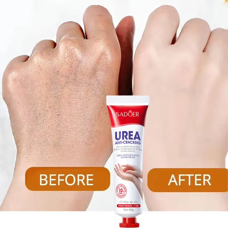 Thumbnail 3 - #1 Trending Hand Care Right Now