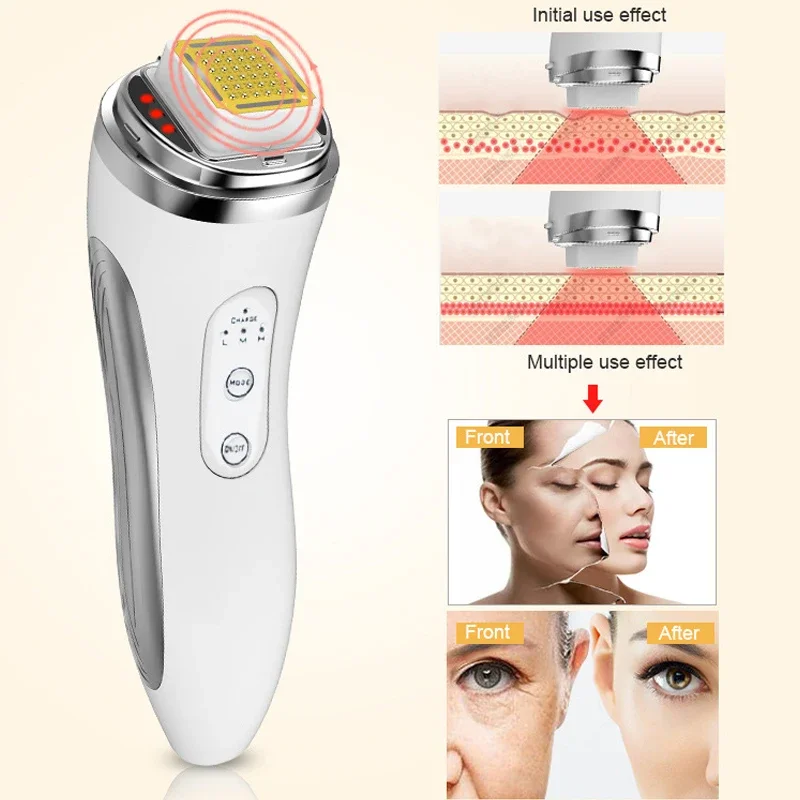 

Dot Matrix Radio Frequency Facial Lifting Remove Wrinkle RF Fractional Face Lift Skin Rejuvenation Home Body Care Beauty Device