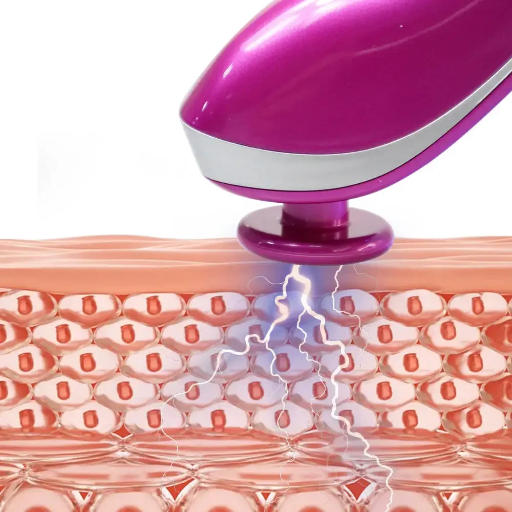 Ozone Plasma Acne Removal Device - USB Portable Facial Treatment Tool for Acne, Blackheads, Wrinkles & Skin Tightening | At Home